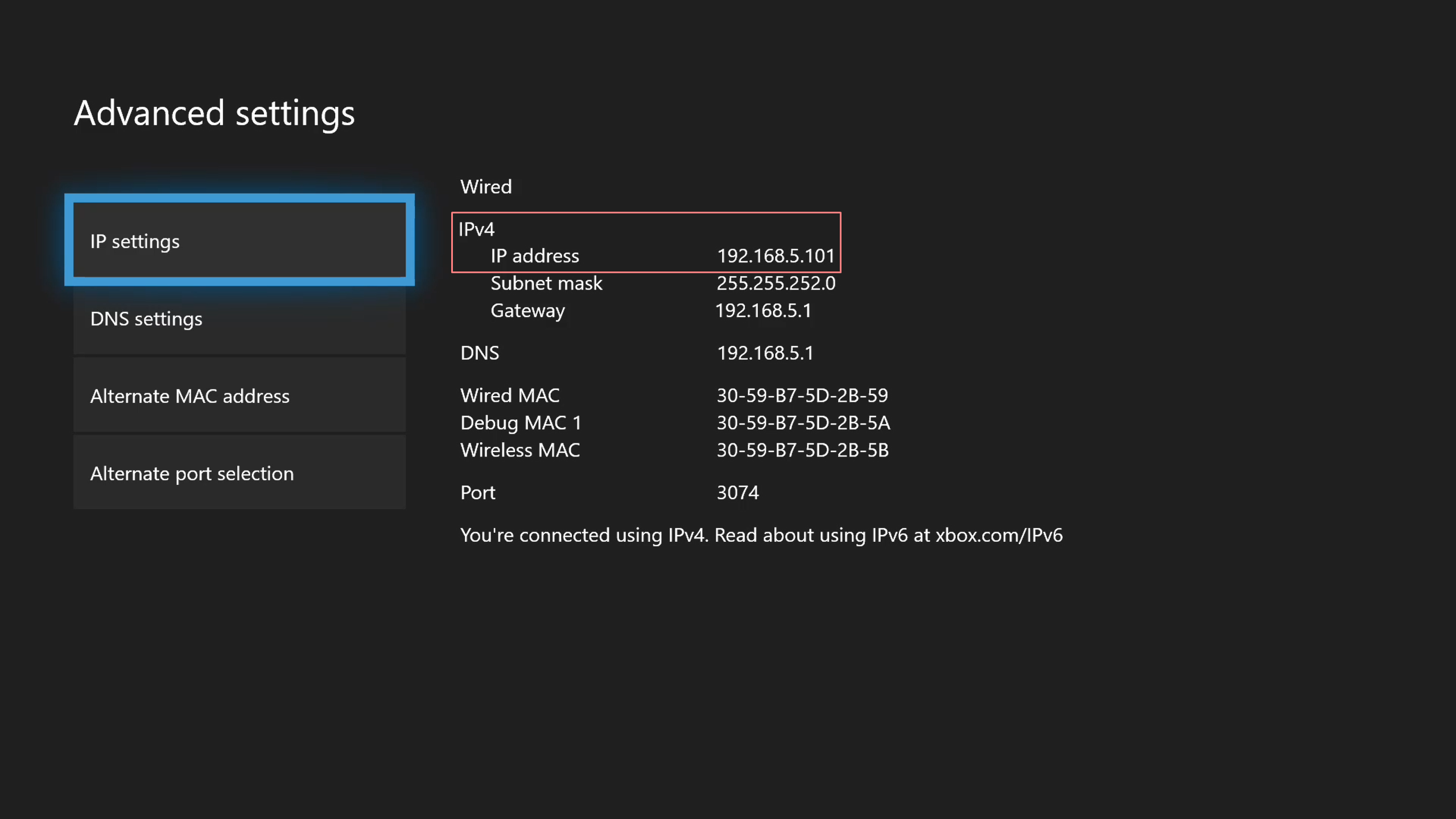 how to reset xbox network settings